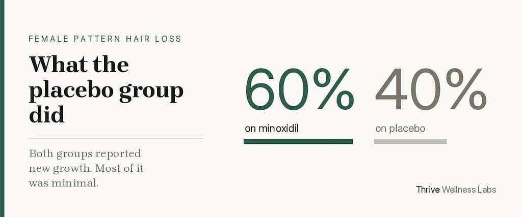 Female pattern hair loss treatment evidence — 60% of women reported regrowth on minoxidil and 40% on placebo